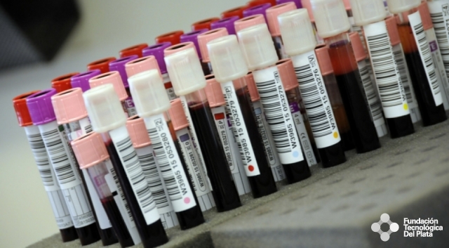 Este análisis de sangre podría revelar los casos exactos de COVID-19. Imagen Miniatura